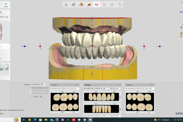 Protesi mobili DIGITALE  funzionali e confortevoli