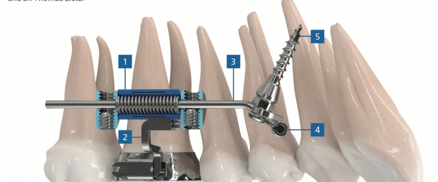 Una continua e costante ricerca delle migliore tecniche ortodontiche per i nostri pazienti
